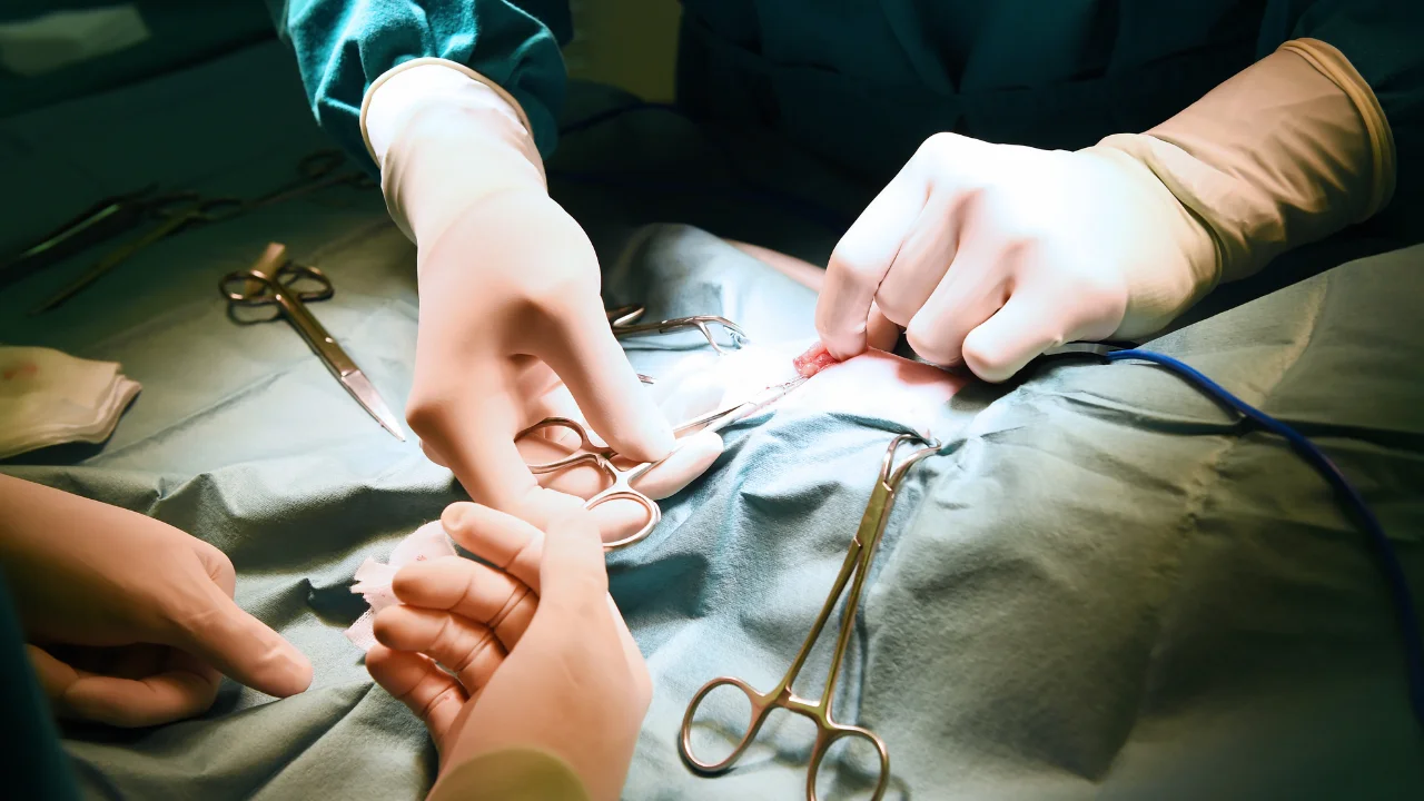 Chirurgie Generală