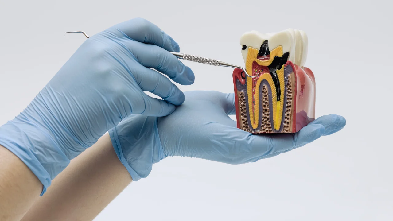 Endodonție