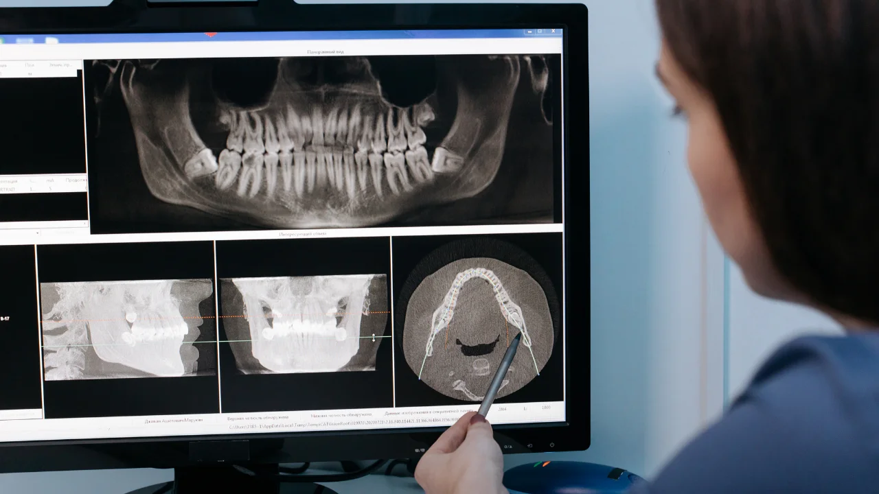 Radiologie Dentară