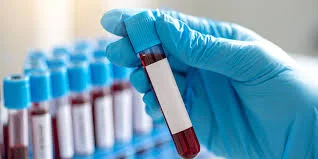 Laborator Clinic Dr. Berceanu - Clinică medicală Timișoara
